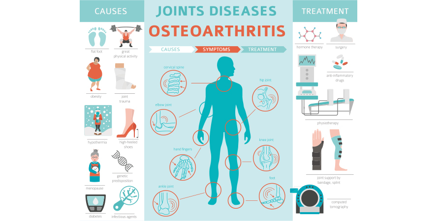 can stress cause joint pain – osteoarthritis and inflammation