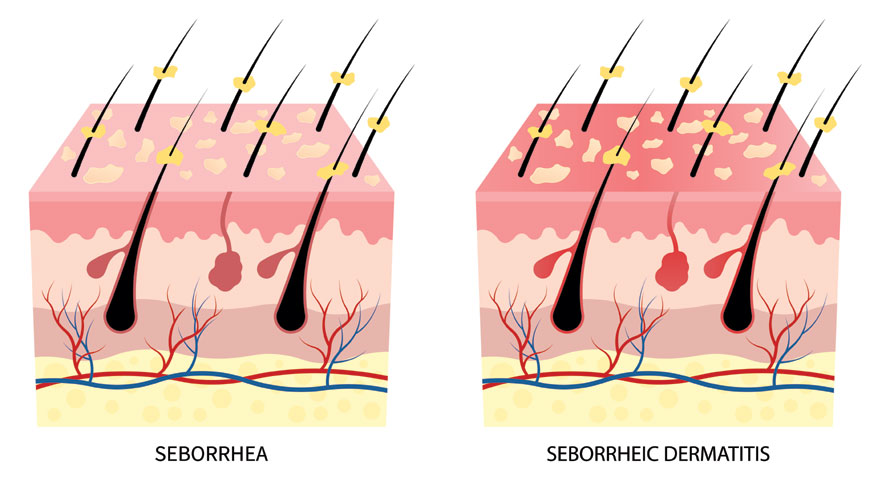 Hair growth problems
