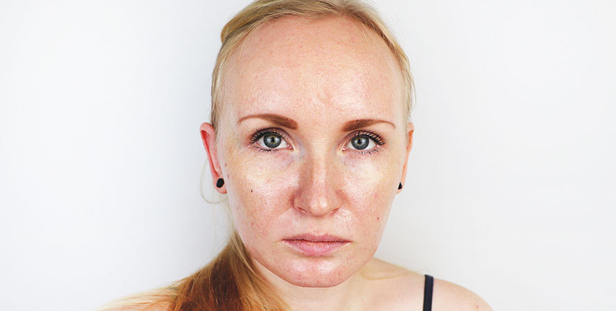 Oily Skin