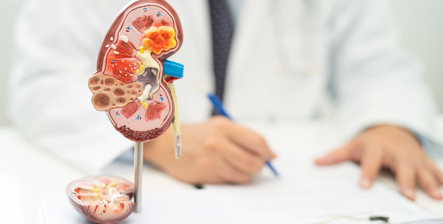 Doctor with kidney anatomy model