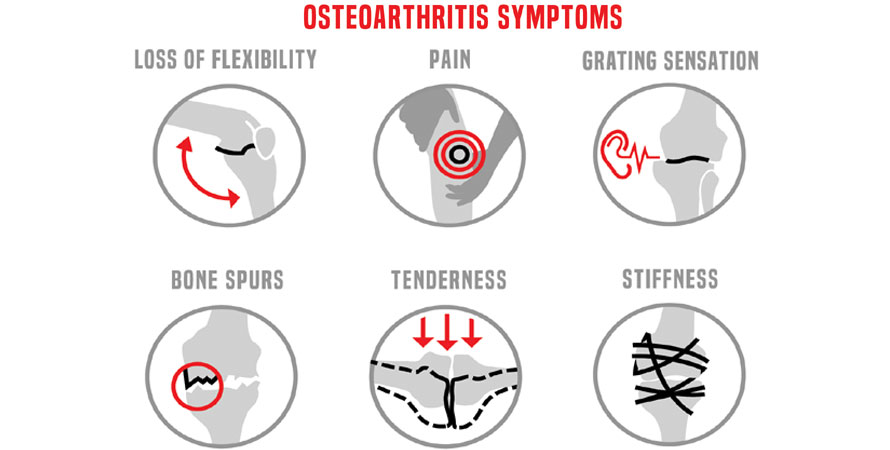 Symptoms of Osteoarthritis