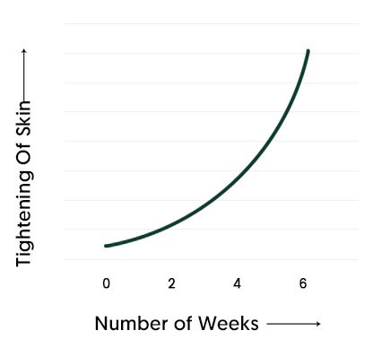 Revivatone Graph 03