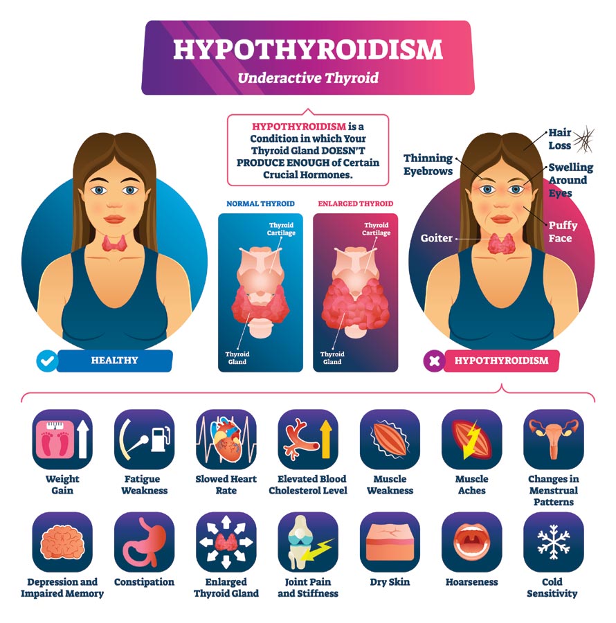 Underactive Thyroid