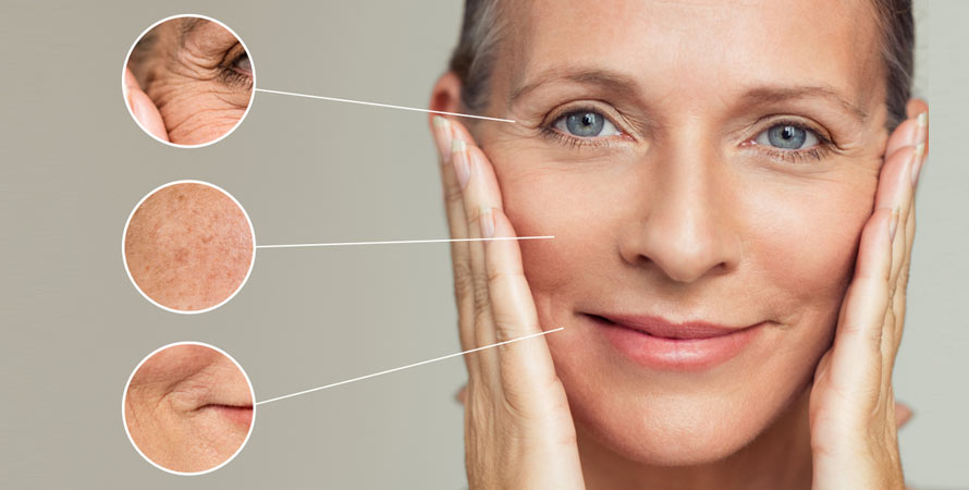 Types of Wrinkles